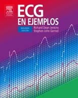 ECG EN EJEMPLOS | 9788481749045 | JENKINS, RICHARD DEAN / GERRED, STEPHEN JOHN