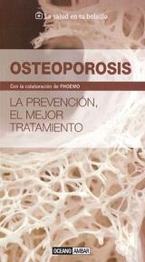 OSTEOPOROSIS | 9788475567990